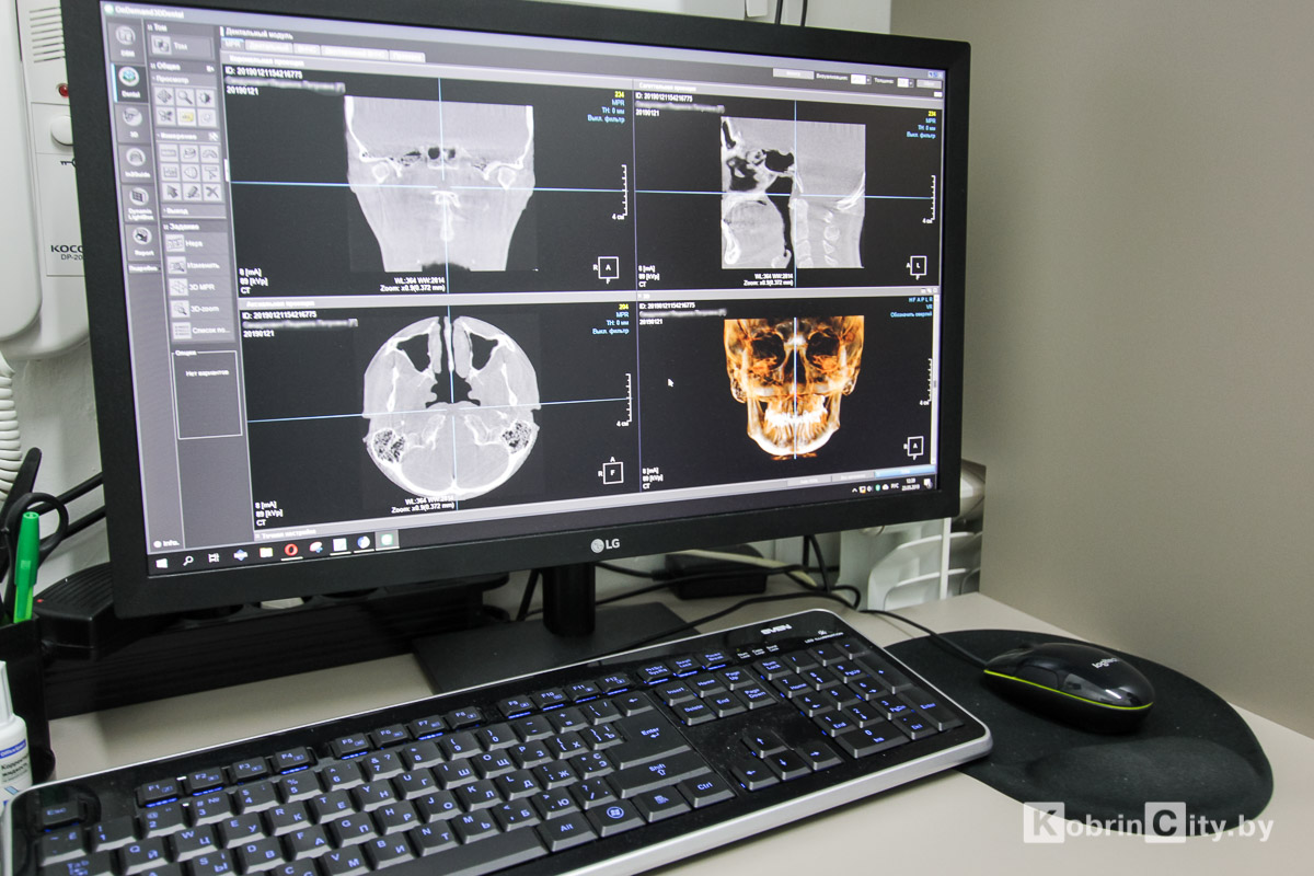 3D-снимок зубов в Кобрине. 3D-томограф в стоматологии «ДЕКО»