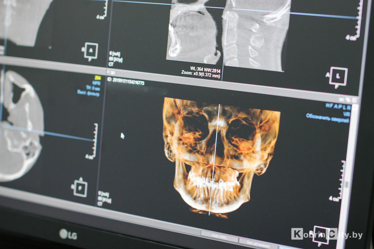 3D-снимок зубов в Кобрине. 3D-томограф в стоматологии «ДЕКО»