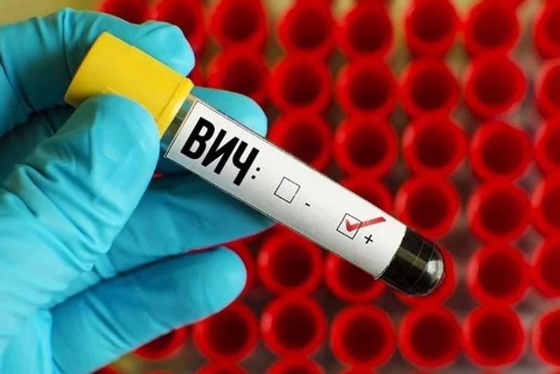 Где в Кобринском районе можно обследоваться и узнать свой ВИЧ-статус — это анонимно и бесплатно