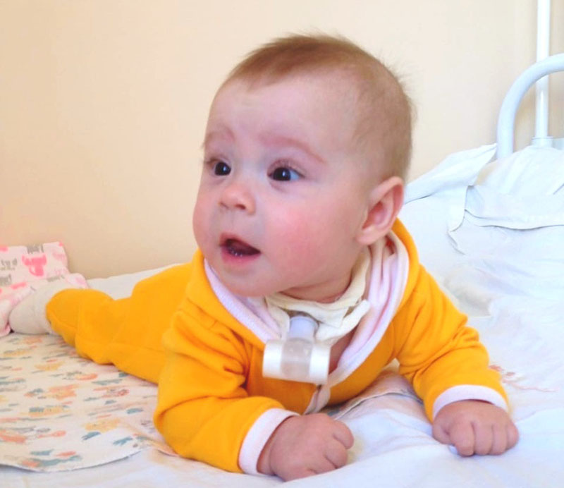 «Я очень хочу поставить доченьку на ноги». Семье 5-летней Софии Сосенковой из Кобрина нужна помощь